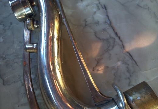 neck left side (61 visits) neck left side