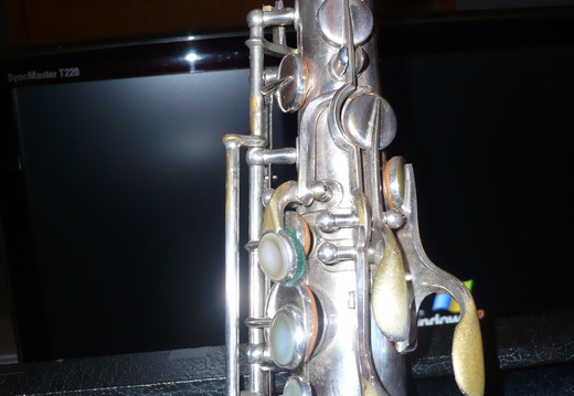 Left Side Upper Portion (126 visits) Left Side Upper Portion