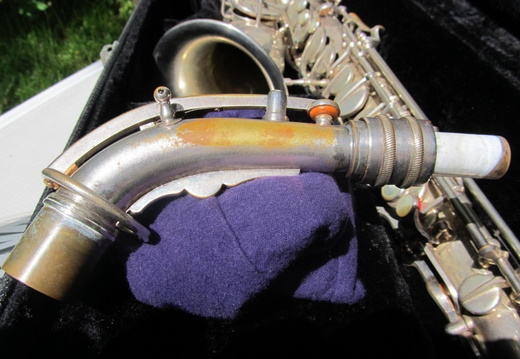 Neck Left Side (171 visits) Neck Left Side