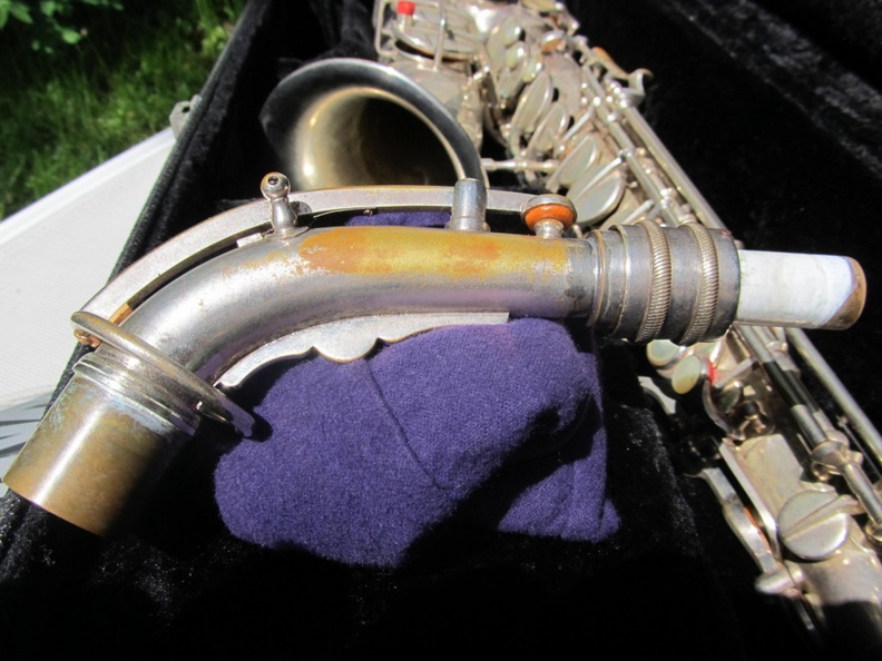 Neck Left Side (526 visits) Neck Left Side