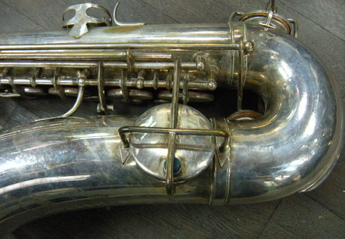 Left Side Lower Portion (341 visits) Left Side Lower Portion