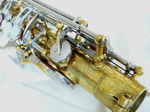 front view upper portion