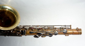 left side upper portion